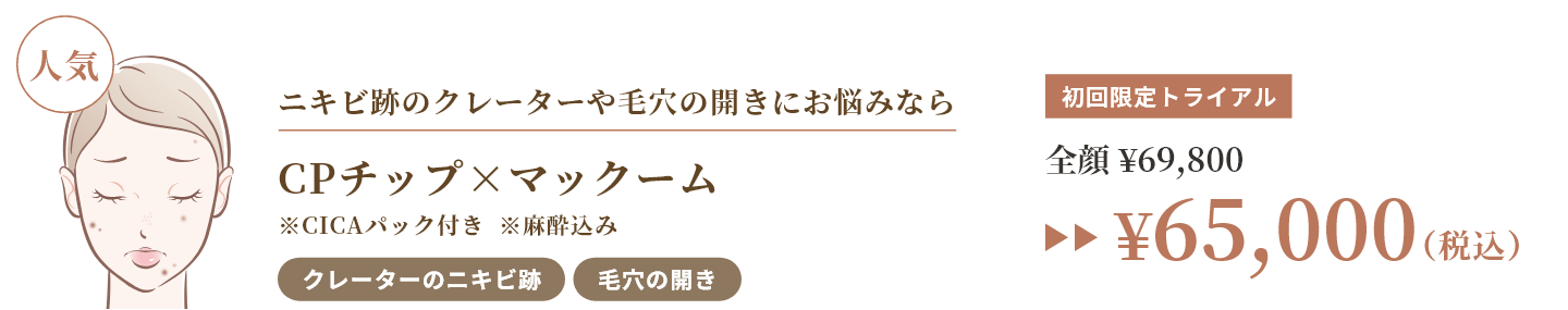 CPチップ×マックーム