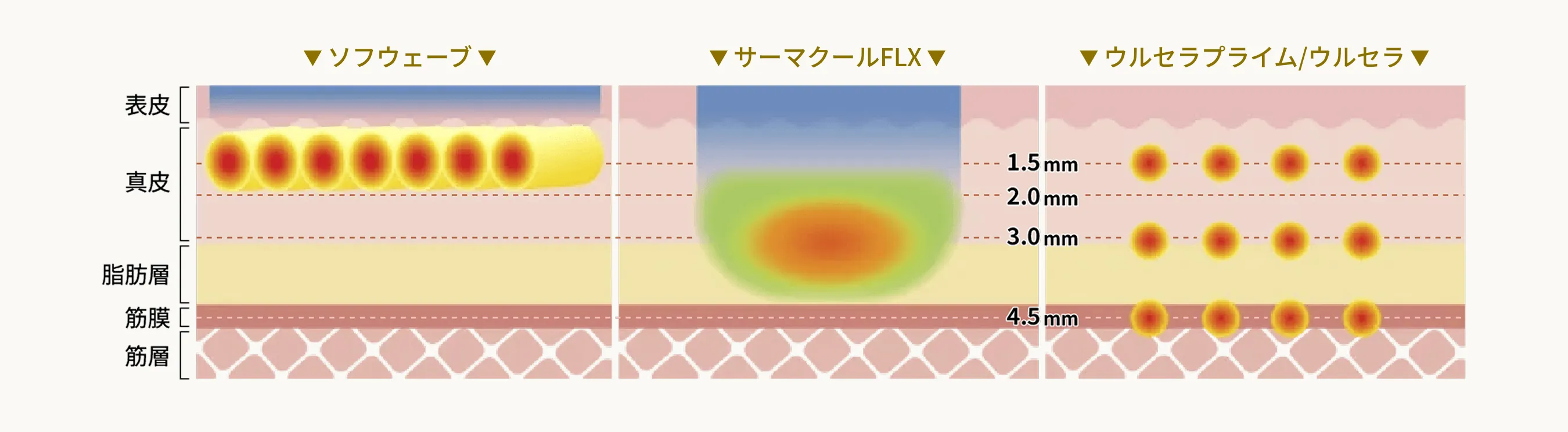 アプローチする層の違いの図解